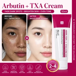 Arbutin + Tranexamic Acid Cream Dark Spot Corrector Brightening Even Skin Tone Hyperpigmentation Fading Face Cream 50ml