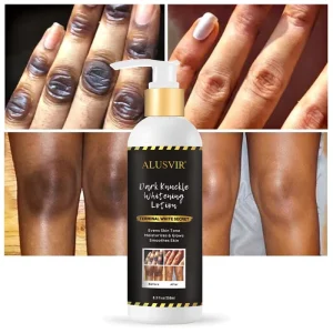 Private Label Skin Whitening Body Cream for Dark Spot Removal and Lightening